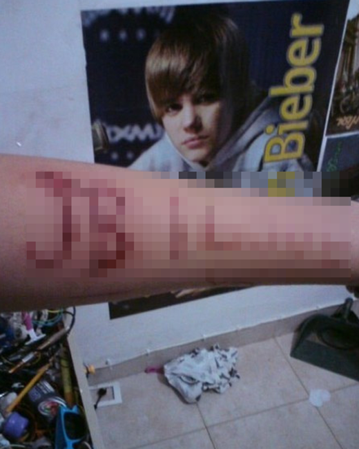 
	
	Có fan còn dùng dao rạch lên tay mình dòng chữ: JB I Love.
